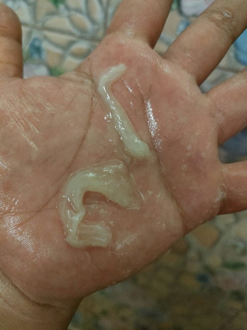 ตอนนี้อายุครรภ์38วีคแล้วกำหนดคลอด16กรกฎาคม