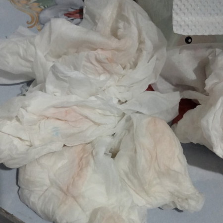 ขออนุญาตสอบถามแม่ๆหน่อยค่ะ ท้อง3เดือน แล้วเป็นแบบนี้อัตรายไมค่ะก่อนหน้านี้มีปวดท้องด้วยค่ะ