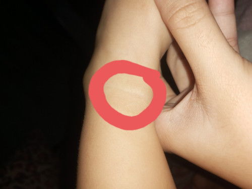 ano po Kaya ito? ano po pwedeng ipang gamot?