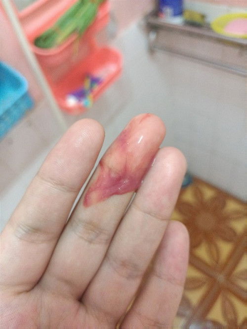 39+2 หมอแต่ละที่ไม่เหมือนกันจริงๆ😂