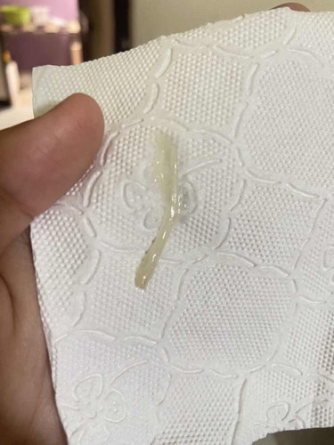 มีมูกออกแบบนี้ควรไปหาหมอเลยไหมคะ37+5วีค