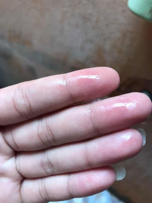 37+2 วีค ใช่มูกใสไหมคะ