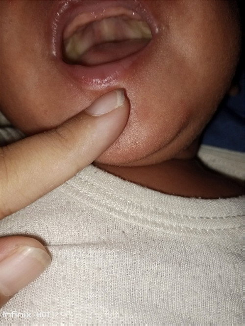 Warna mulut bayi