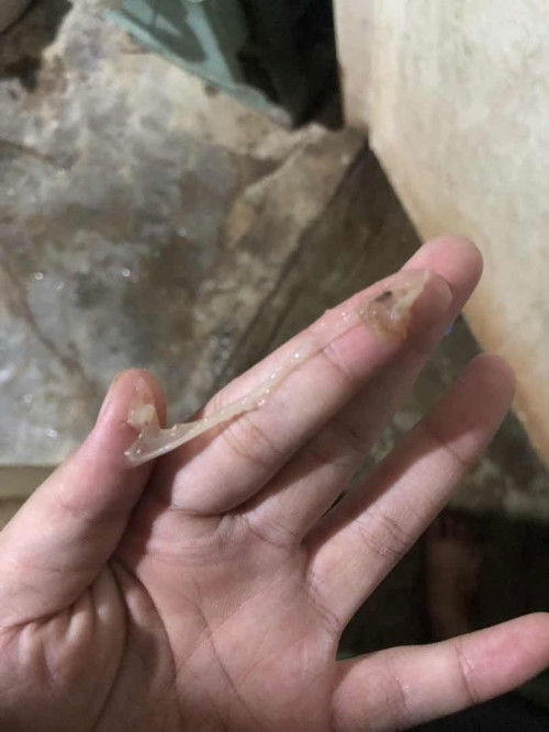 ใกล้คลอด 39+3