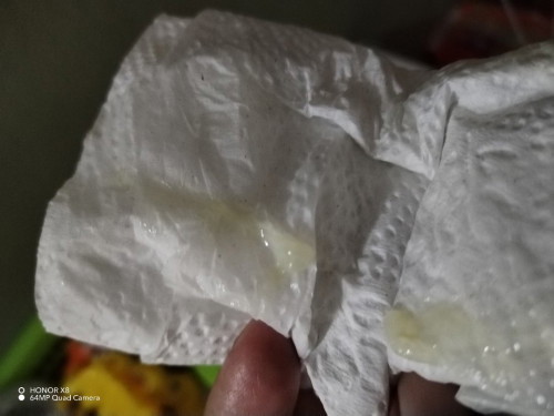 MUCUS PLUG OR KEPUTIHAN?