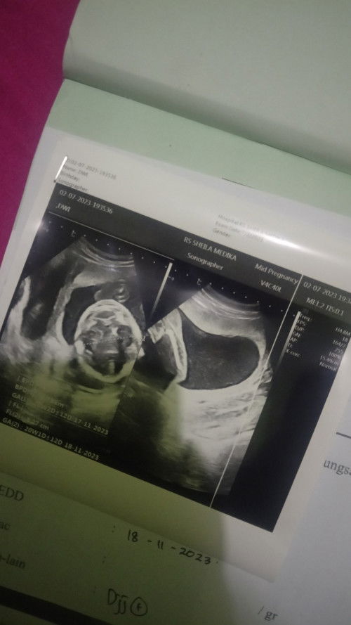 Mau bertanya mengenai gambar hasil usg