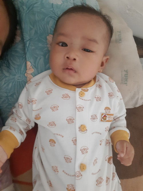 Mata bayi lazy eyelid