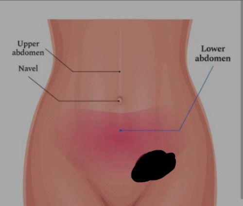 ASK LANG PO FIRST TIME MOM PO KASE AKO, NORMAL PO BA SA 18 WEEKS ANG SUMAKIT OR KUMIROT NG PAPITIK