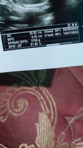 .ini bagus enggk ya bun ,hasil usg nya bwt usia kandungan 36w ?
.tolong di koreksi ya bun ...