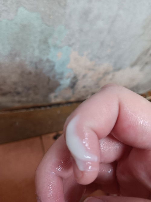 ตกขาวใช่มั้ยคะ