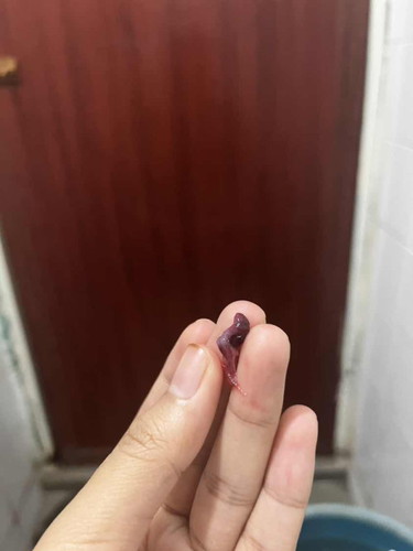 Ni apa ya?