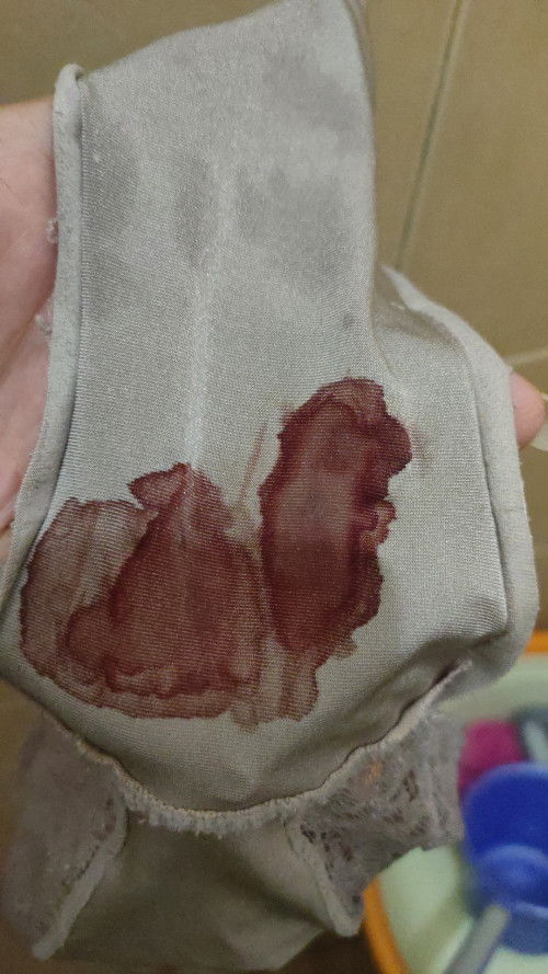 Flek Darah merah pada malam hari