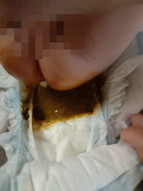 2 months old baby watery/ brown mocus poop 
first time mom...