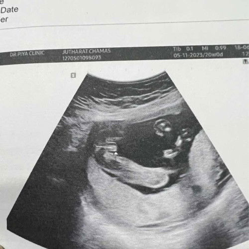 แม่ๆแบบนี้เพศอะไรคะ