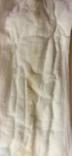 Keputihan atau darah