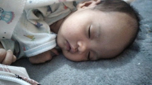 Bintik2 seluruh badan