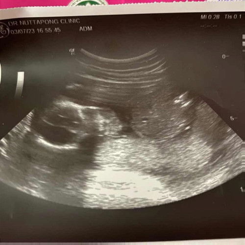 ช่วยดูหน่อยค่ะ