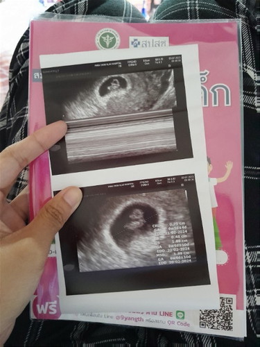 ฝากครรภ์ครั้งแรกของตัวน้อยของแม่🤰🏻🥰