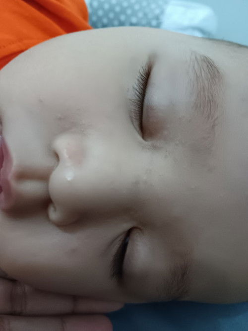 Bintik merah di alis hidung sekitar mata