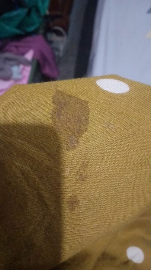 Keputihan atau ketuban