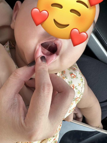 Baby 8bulan 6hari