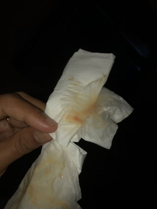 Keluar lendir darah
