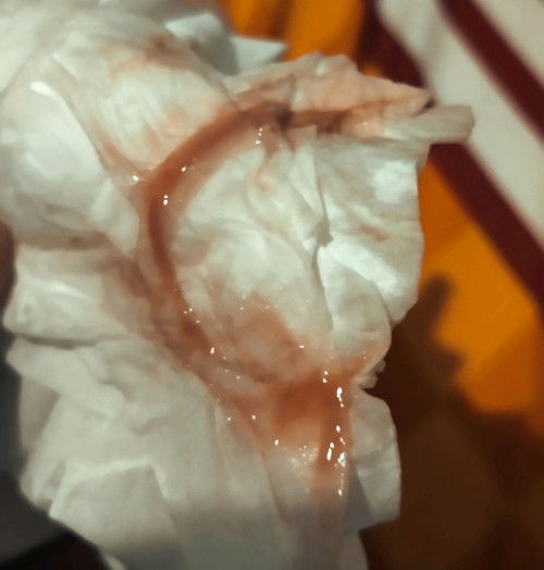 Kapan ke rumah sakit?