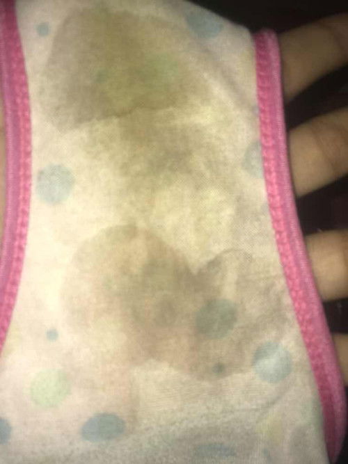 Pendarahan bukan ya?