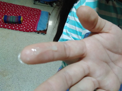 แบบนี้เรียกมูกใสๆมั้ยค่ะ