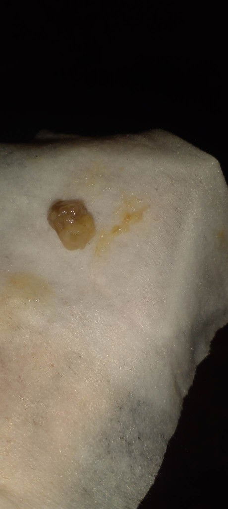 ใช่มูกเลือดไม้