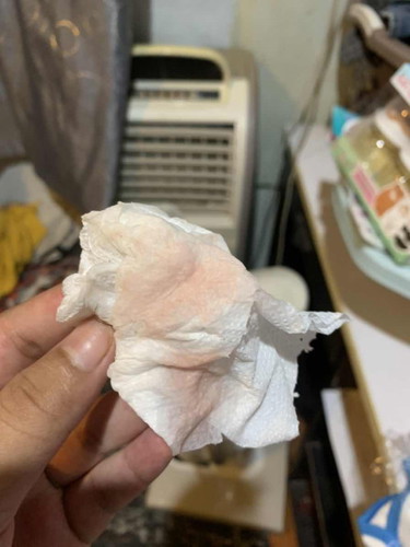 ถามแม่ๆ แบบนี้ปกติมั้ยค่ะ