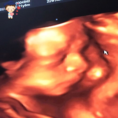 กังวลเรื่องน้ำหนักน้องค่ะ