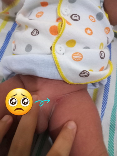 Luka basah di daerah selangkang