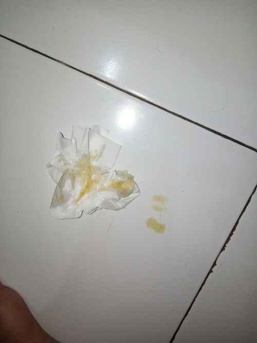 Air ketuban bukan ya?