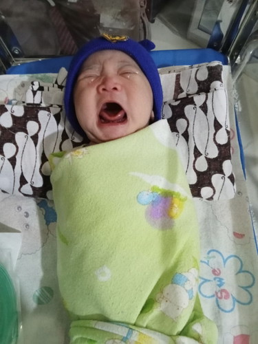Butuh sharing dong Bun ,apa ya kok seperti tumbuh gigi di gusi bayi ku ,,baru lahir