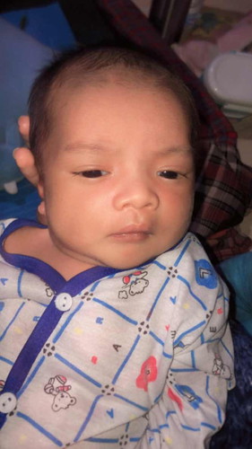 Rambut bayi rontok kenapa yah