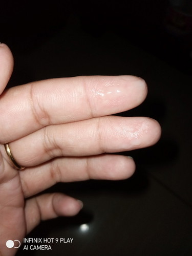 Bun mau tanya keluar flek putih