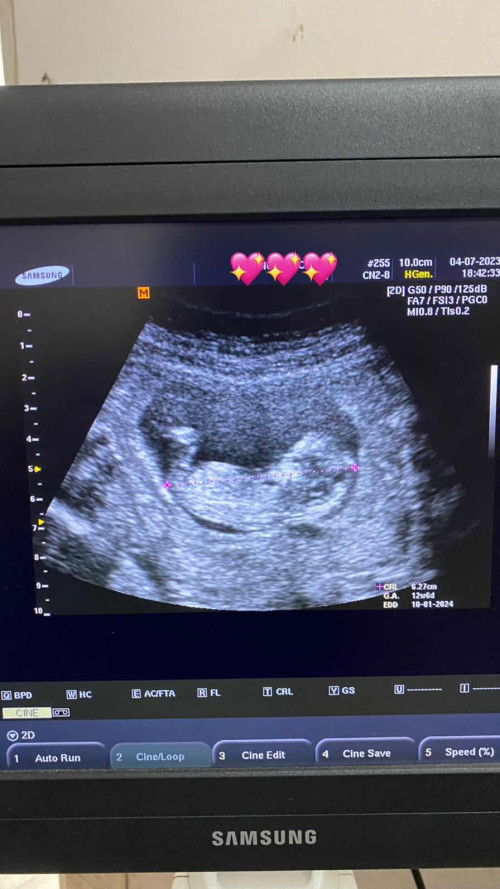 อยากทราบน้ำหนักตัวน้อยย