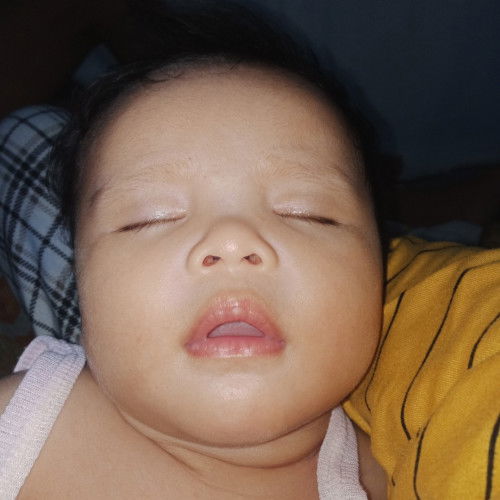 Ano gamot pra sa baradong ilong