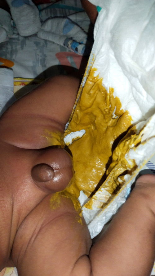 Maaf jorok. Boleh skip!!