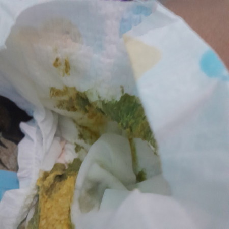 Is it normal?