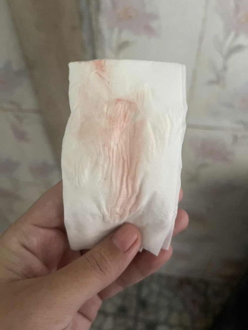 ขออนุญาตสอบถามค่ะ แม่ๆ