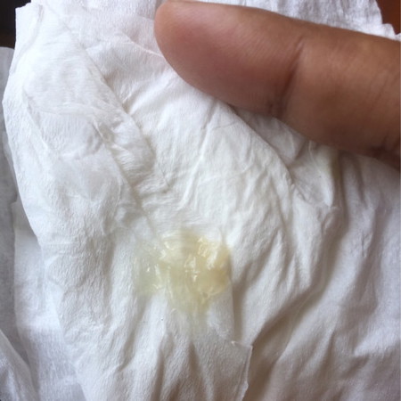 อายุครรภ์ 38+4