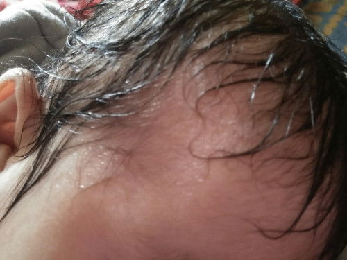 Halo bunda2..
Mengapa ea anak saya kalo lgi nen keringat di kepala sampai rambutnya basah sekali