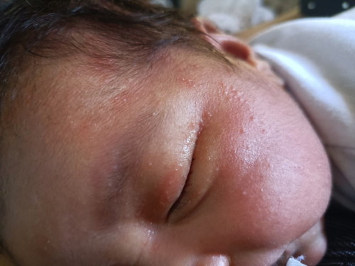 Butilbutil newborn