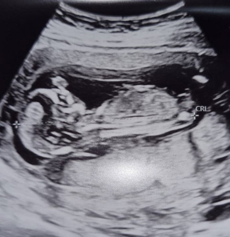 ลูกสาว หรือ ลูกชาย คะ ใครดูเป็นบ้าง