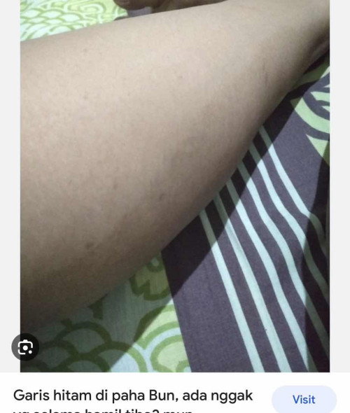 Kaki belang jadi 2 tone colour