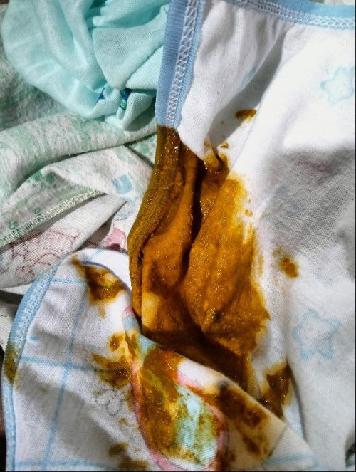 Bab cair newborn 2 minggu