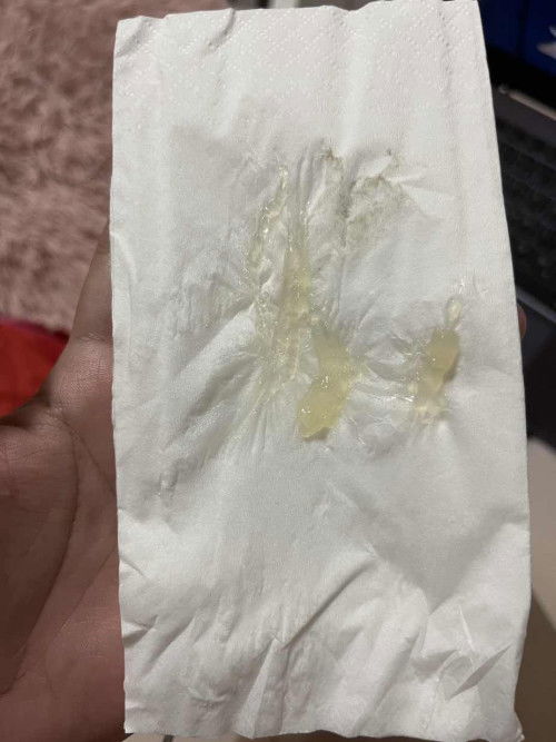 แบบนี้คือปากมดลูกเปิดมั้ยคะ