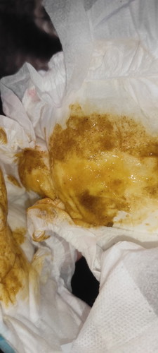 Feses encer dan berbusa